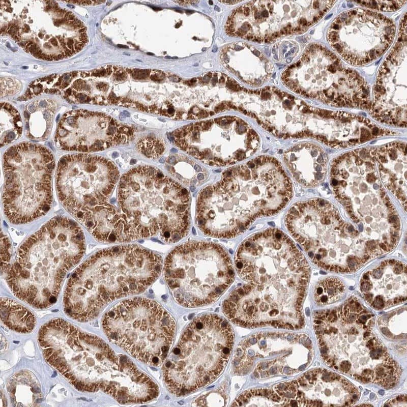 BMERB1 Antibody - BSA Free Immunohistochemistry-Paraffin: BMERB1 Antibody [NBP1-81996]