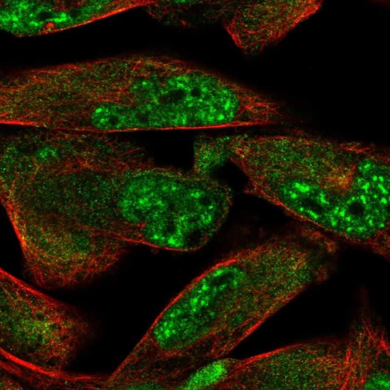 ZDHHC15 Antibody - BSA Free Immunocytochemistry/ Immunofluorescence: ZDHHC15 Antibody [NBP1-82014]