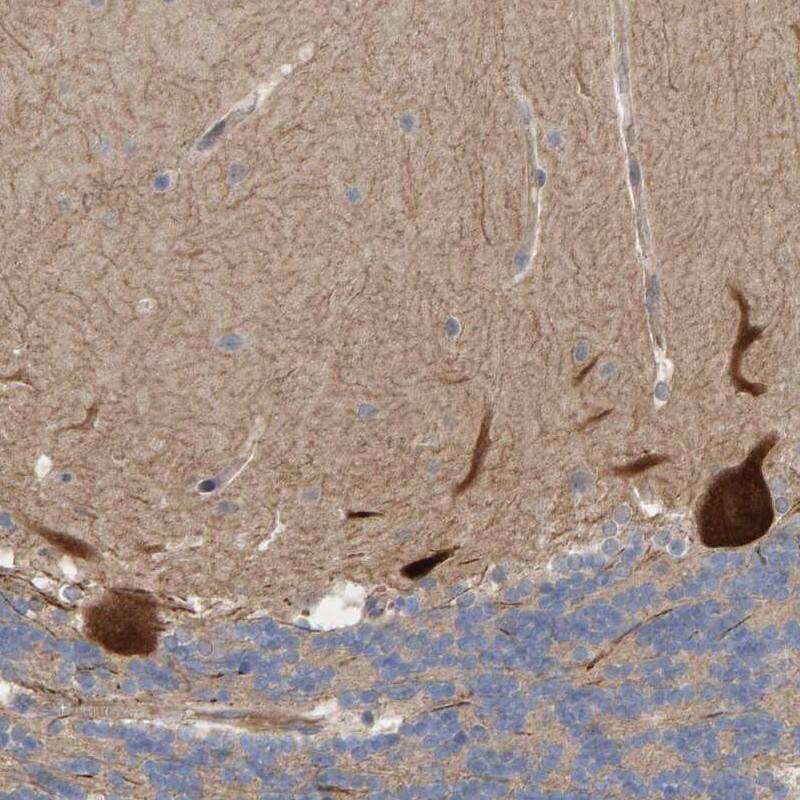 LRSAM1 Antibody - BSA Free Immunohistochemistry-Paraffin: LRSAM1 Antibody [NBP1-82017]