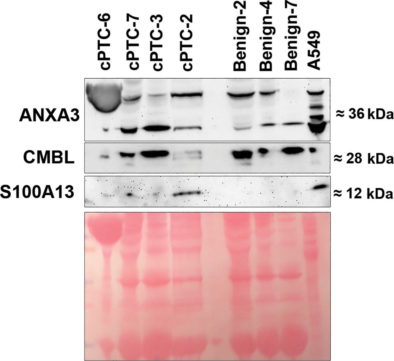 CMBL Antibody