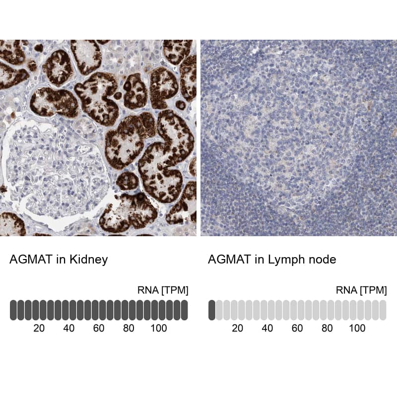 AGMAT Antibody - BSA Free Immunohistochemistry-Paraffin: AGMAT Antibody [NBP1-82080]