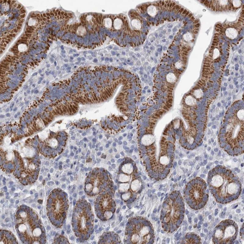 AGMAT Antibody - BSA Free Immunohistochemistry-Paraffin: AGMAT Antibody [NBP1-82080]