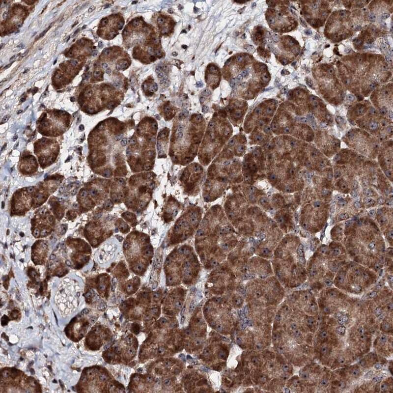 FAM111A Antibody - BSA Free Immunohistochemistry-Paraffin: FAM111A Antibody [NBP1-82103]