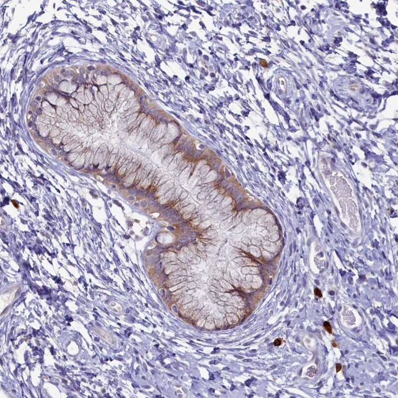 METTL25 Antibody - BSA Free Immunohistochemistry-Paraffin: METTL25 Antibody [NBP1-82105]