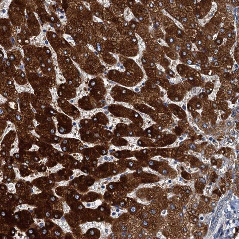 ZC3H7A Antibody - BSA Free Immunohistochemistry-Paraffin: ZC3H7A Antibody [NBP1-82187]