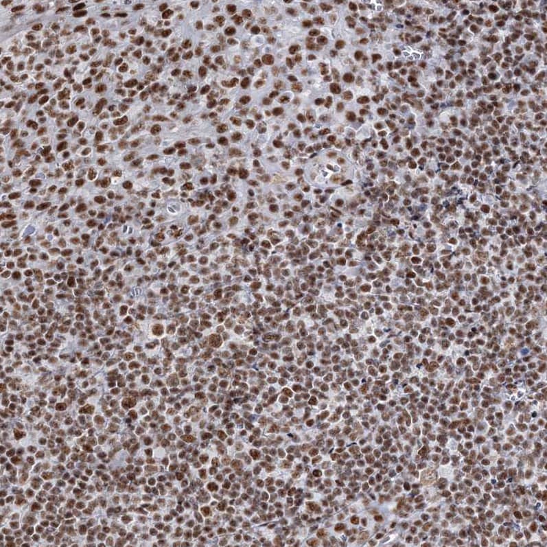 QRICH1 Antibody - BSA Free Immunohistochemistry-Paraffin: QRICH1 Antibody [NBP1-82196]