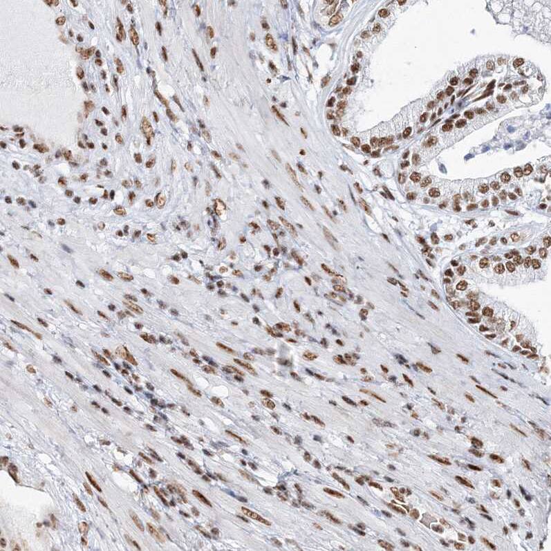 QRICH1 Antibody - BSA Free Immunohistochemistry-Paraffin: QRICH1 Antibody [NBP1-82196]
