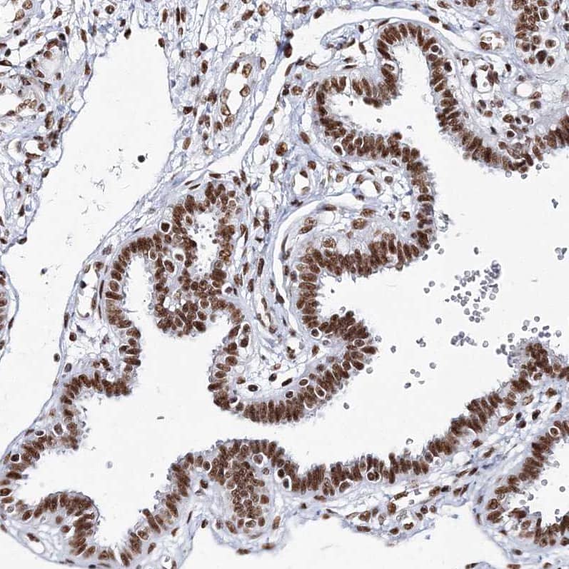 QRICH1 Antibody - BSA Free Immunohistochemistry-Paraffin: QRICH1 Antibody [NBP1-82196]