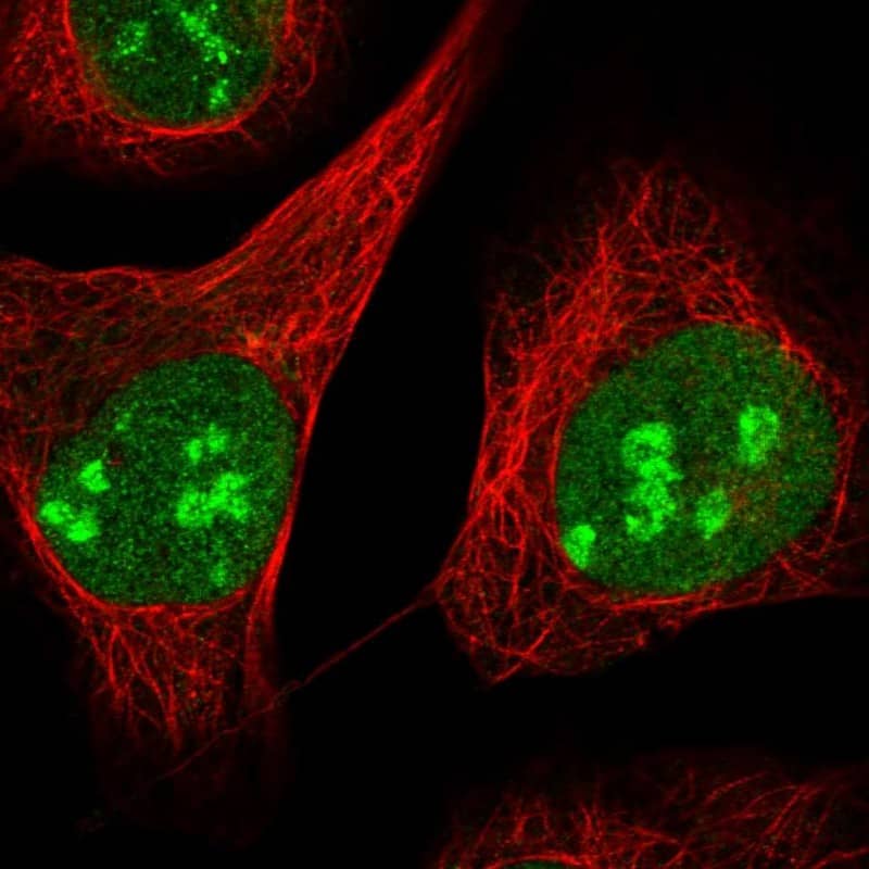ZCCHC10 Antibody - BSA Free Immunocytochemistry/ Immunofluorescence: ZCCHC10 Antibody [NBP1-82206]