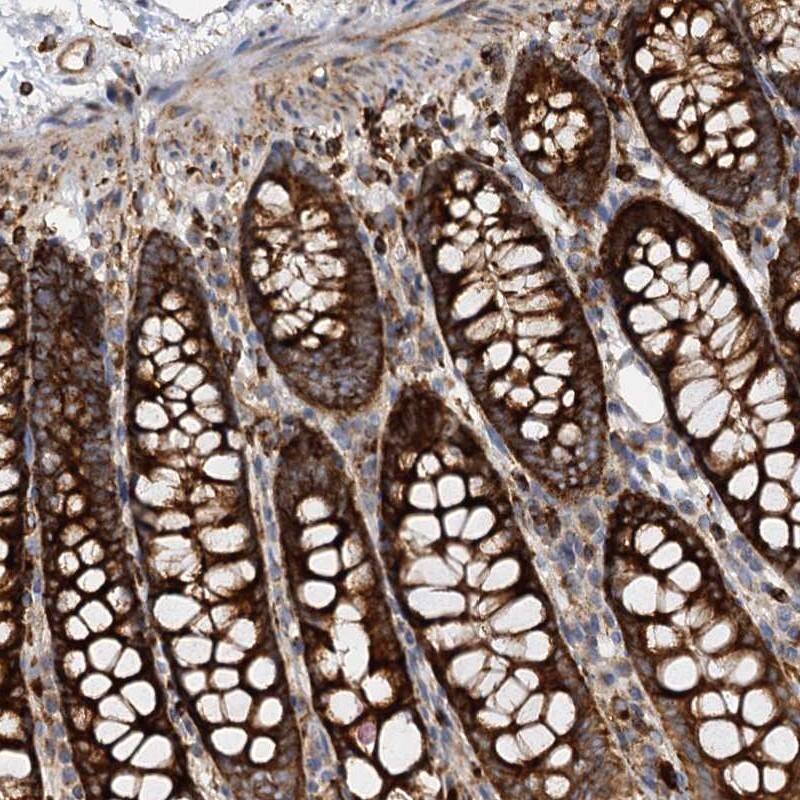 WDR73 Antibody - BSA Free Immunohistochemistry-Paraffin: WDR73 Antibody [NBP1-82219]