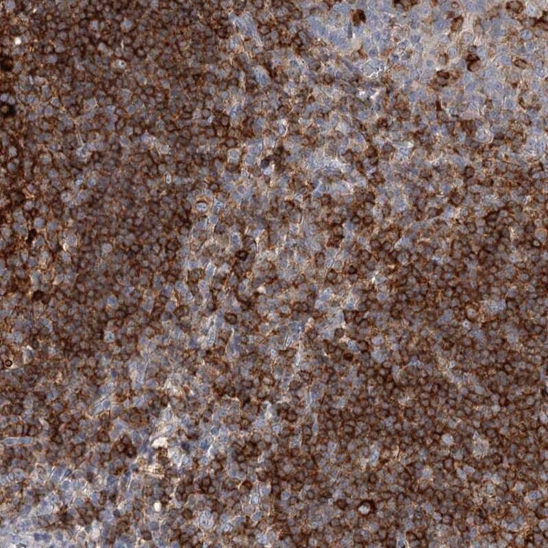SNX22 Antibody - BSA Free Immunohistochemistry-Paraffin: SNX22 Antibody [NBP1-82244]