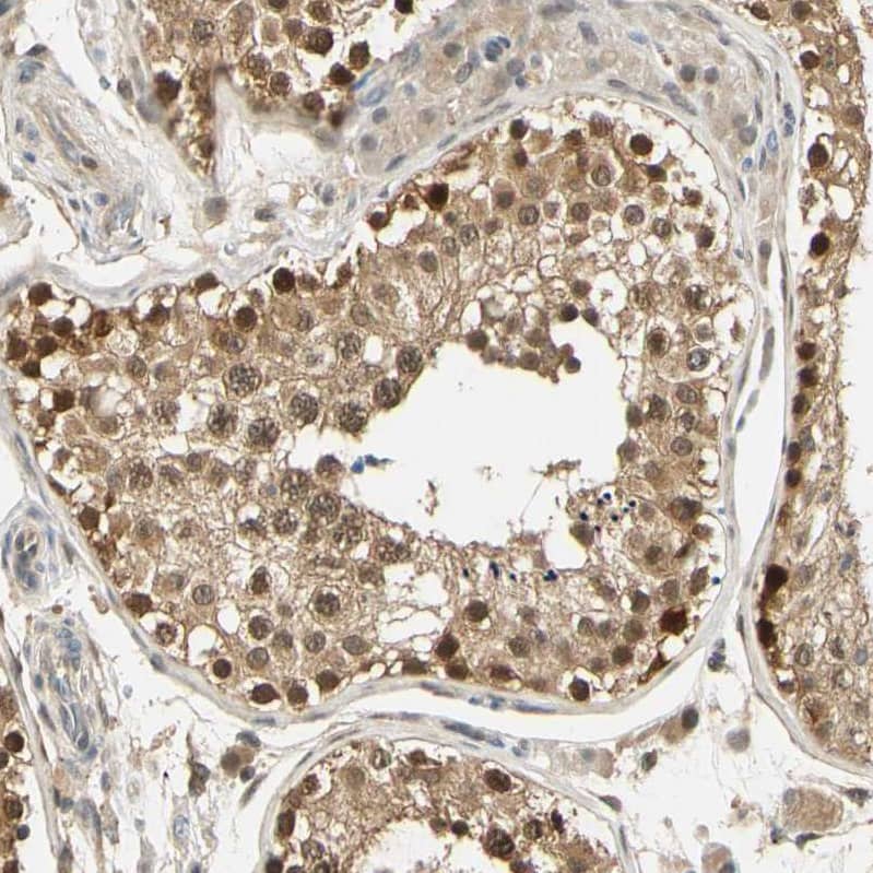 UBE2Z Antibody - BSA Free Immunohistochemistry-Paraffin: UBE2Z Antibody [NBP1-82245]