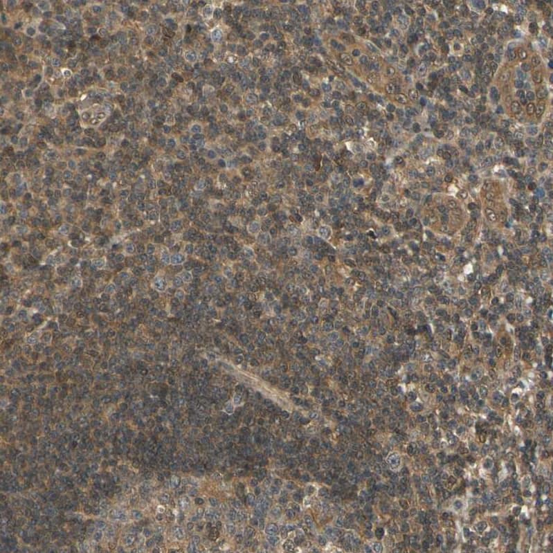 UBE2Z Antibody - BSA Free Immunohistochemistry-Paraffin: UBE2Z Antibody [NBP1-82245]