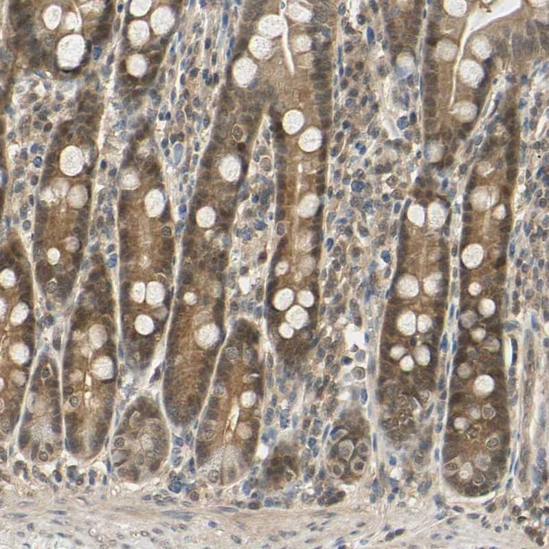 UBE2Z Antibody - BSA Free Immunohistochemistry-Paraffin: UBE2Z Antibody [NBP1-82245]
