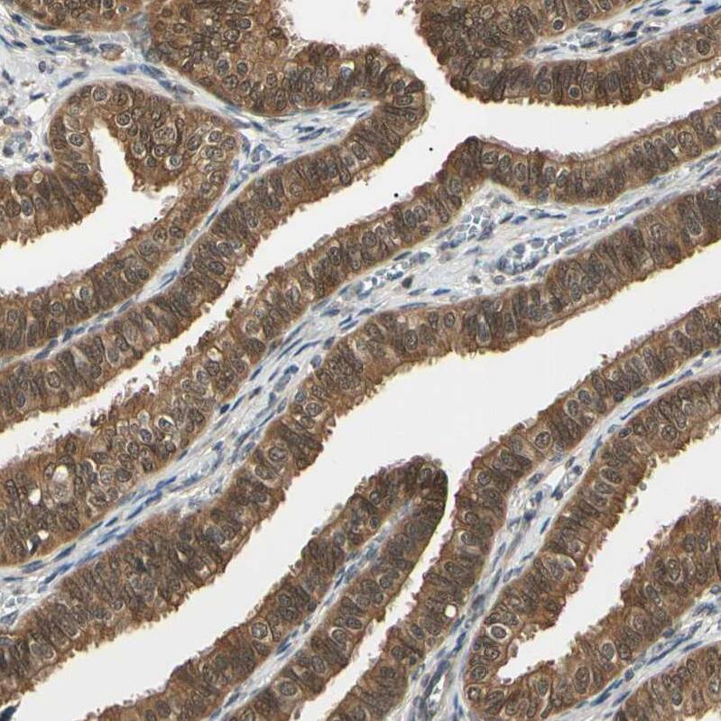 UBE2Z Antibody - BSA Free Immunohistochemistry-Paraffin: UBE2Z Antibody [NBP1-82245]