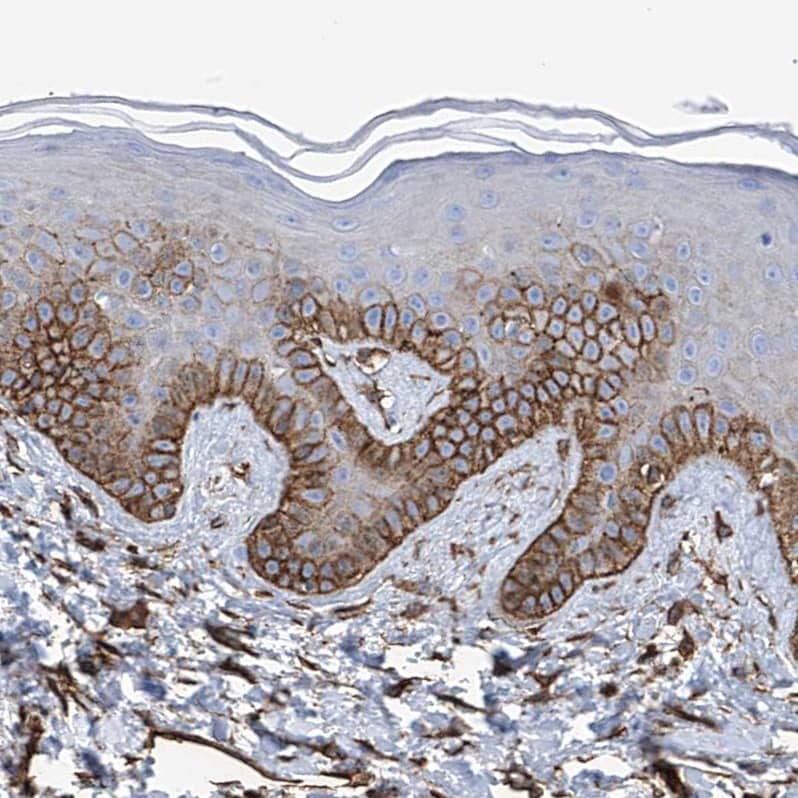 UBTD1 Antibody - BSA Free Immunohistochemistry-Paraffin: UBTD1 Antibody [NBP1-82311]