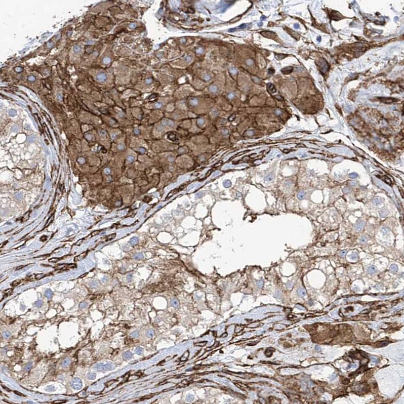 UBTD1 Antibody - BSA Free Immunohistochemistry-Paraffin: UBTD1 Antibody [NBP1-82311]