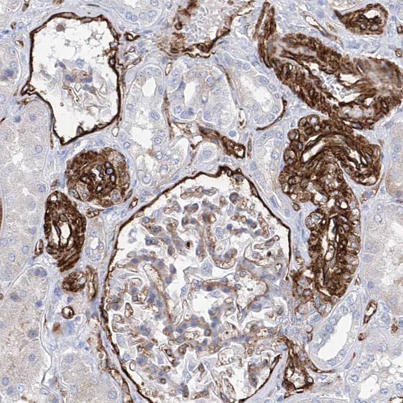 UBTD1 Antibody - BSA Free Immunohistochemistry-Paraffin: UBTD1 Antibody [NBP1-82311]
