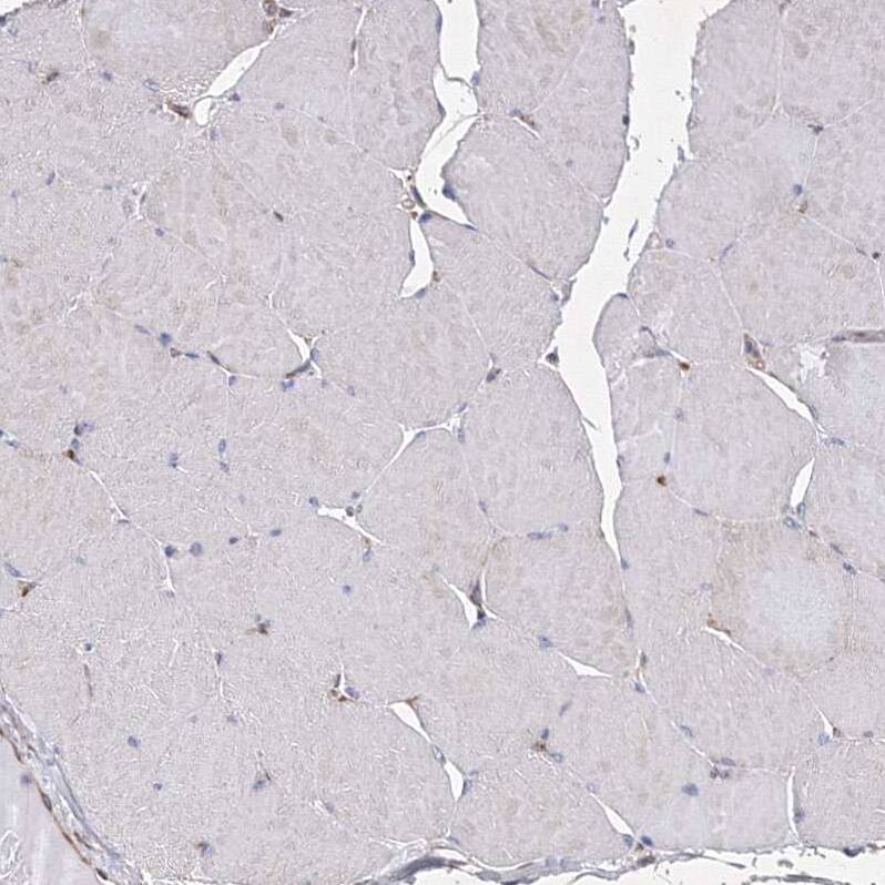SNX18 Antibody - BSA Free Immunohistochemistry-Paraffin: SNX18 Antibody [NBP1-82361]