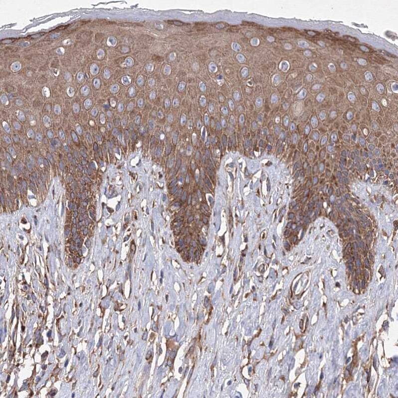 SNX18 Antibody - BSA Free Immunohistochemistry-Paraffin: SNX18 Antibody [NBP1-82361]