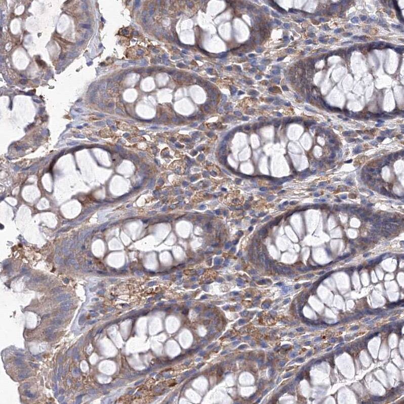 SNX18 Antibody - BSA Free Immunohistochemistry-Paraffin: SNX18 Antibody [NBP1-82361]