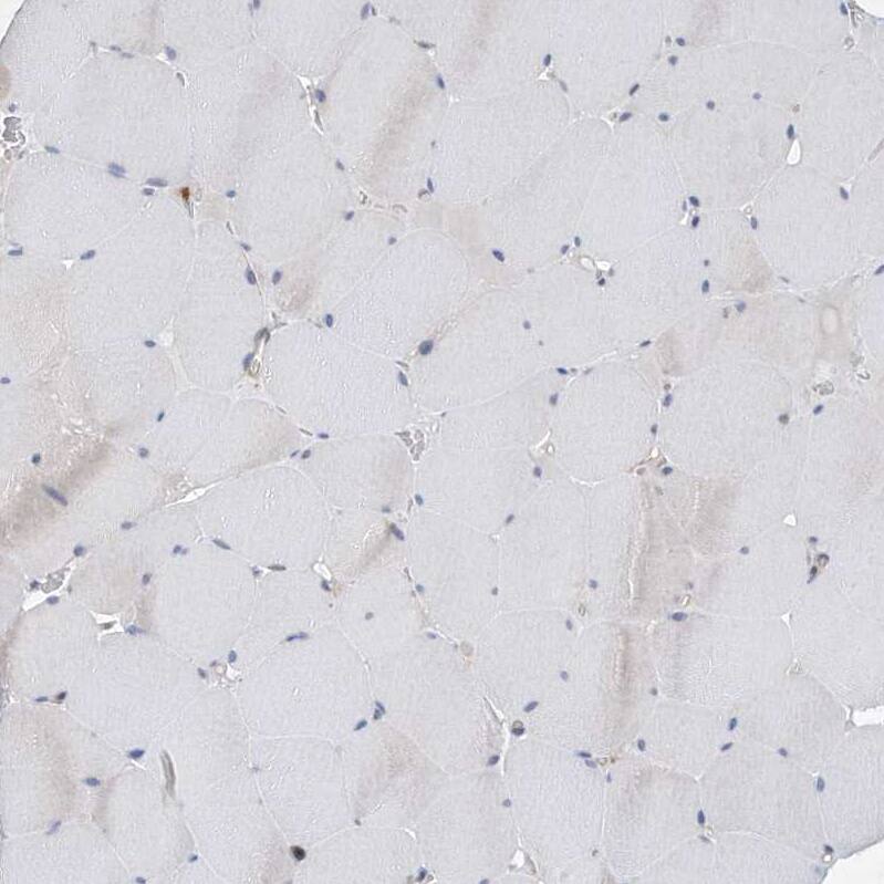 P2Y10/P2RY10 Antibody - BSA Free Immunohistochemistry-Paraffin: P2Y10/P2RY10 Antibody [NBP1-82438]