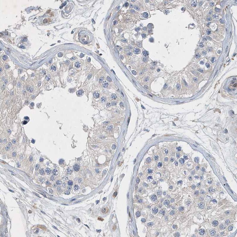 P2Y10/P2RY10 Antibody - BSA Free Immunohistochemistry-Paraffin: P2Y10/P2RY10 Antibody [NBP1-82438]