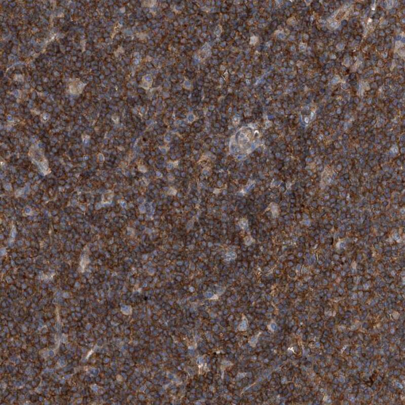 P2Y10/P2RY10 Antibody - BSA Free Immunohistochemistry-Paraffin: P2Y10/P2RY10 Antibody [NBP1-82438]