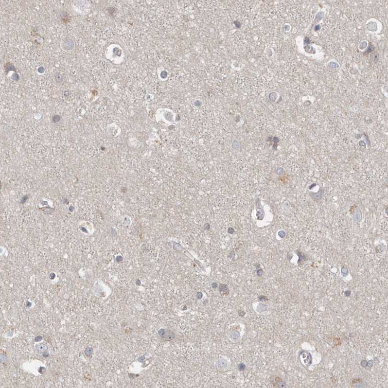 P2Y10/P2RY10 Antibody - BSA Free Immunohistochemistry-Paraffin: P2Y10/P2RY10 Antibody [NBP1-82438]
