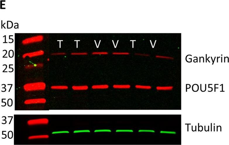 Gankyrin Antibody