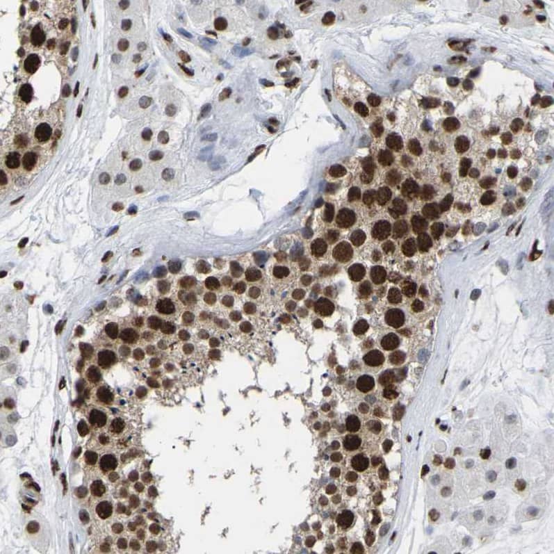 p130 Antibody - BSA Free Immunohistochemistry-Paraffin: p130 Antibody [NBP1-82455]