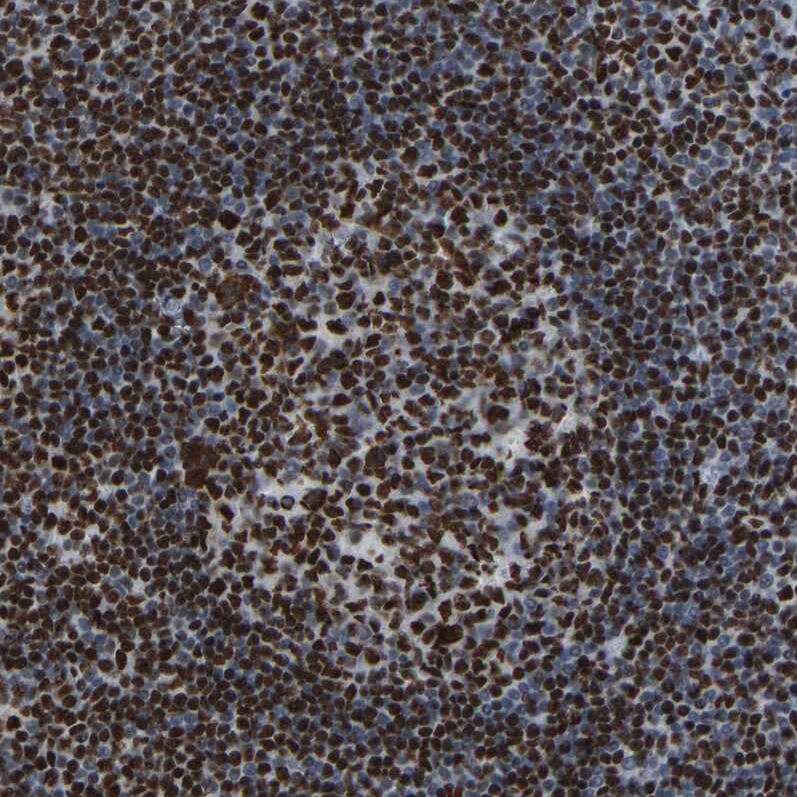 p130 Antibody - BSA Free Immunohistochemistry-Paraffin: p130 Antibody [NBP1-82455]