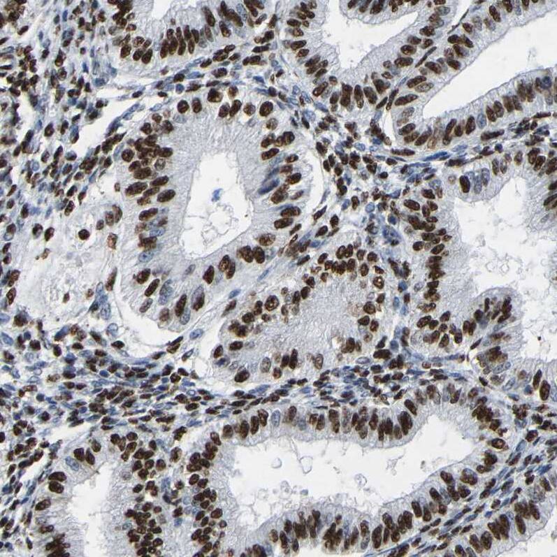 p130 Antibody - BSA Free Immunohistochemistry-Paraffin: p130 Antibody [NBP1-82455]