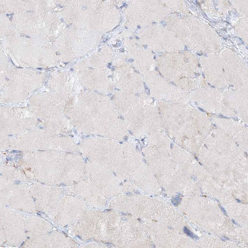 SEC23IP Antibody - BSA Free Immunohistochemistry-Paraffin: SEC23IP Antibody [NBP1-82456]