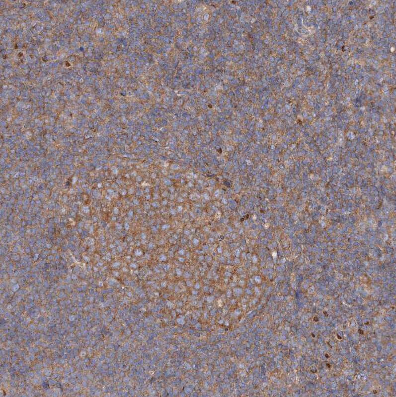 SEC23IP Antibody - BSA Free Immunohistochemistry-Paraffin: SEC23IP Antibody [NBP1-82456]