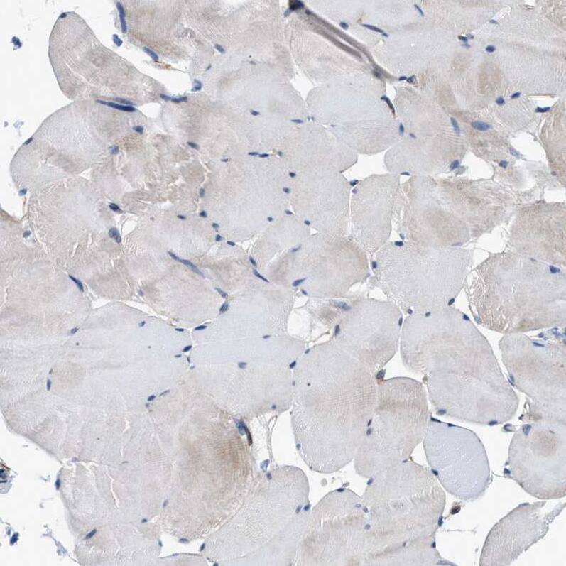 NKTR Antibody - BSA Free Immunohistochemistry-Paraffin: NKTR Antibody [NBP1-82459]