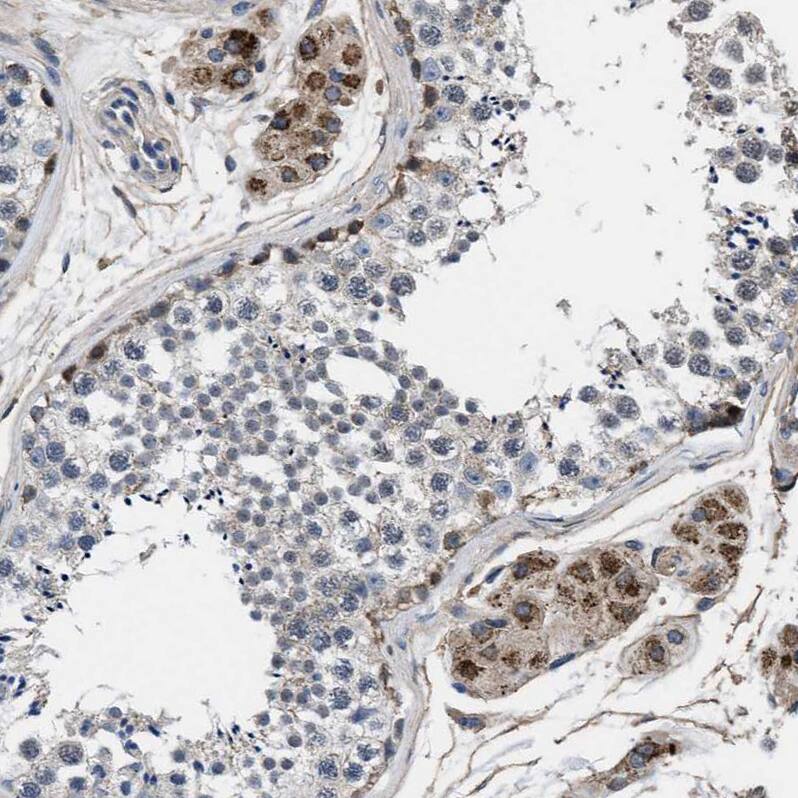 NKTR Antibody - BSA Free Immunohistochemistry-Paraffin: NKTR Antibody [NBP1-82459]