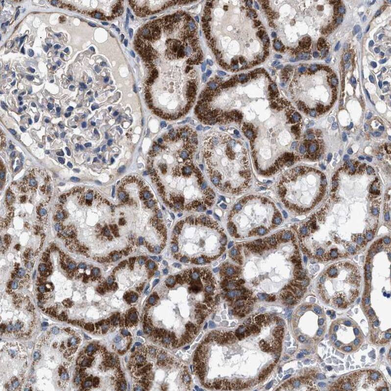 NKTR Antibody - BSA Free Immunohistochemistry-Paraffin: NKTR Antibody [NBP1-82459]