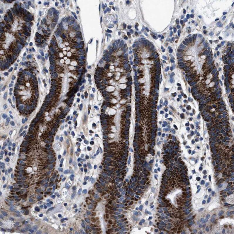 NKTR Antibody - BSA Free Immunohistochemistry-Paraffin: NKTR Antibody [NBP1-82459]