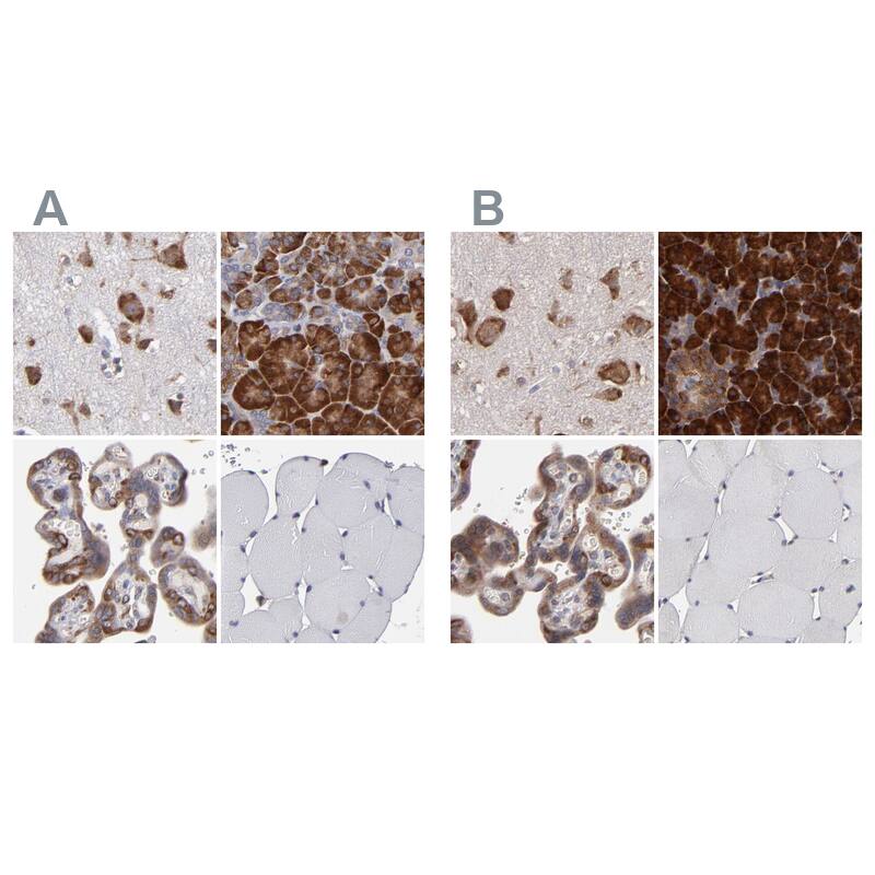 SND1 Antibody Immunohistochemistry-Paraffin: SND1 Antibody Antibody [NBP1-82460]