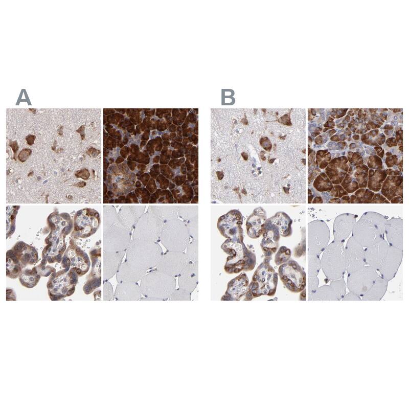 SND1 Antibody Immunohistochemistry-Paraffin: SND1 Antibody Antibody [NBP1-82461]