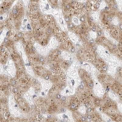 Ribophorin I Antibody - BSA Free Immunohistochemistry-Paraffin: Ribophorin I Antibody [NBP1-82467]