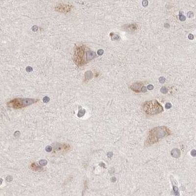 Ribophorin I Antibody - BSA Free Immunohistochemistry-Paraffin: Ribophorin I Antibody [NBP1-82467]