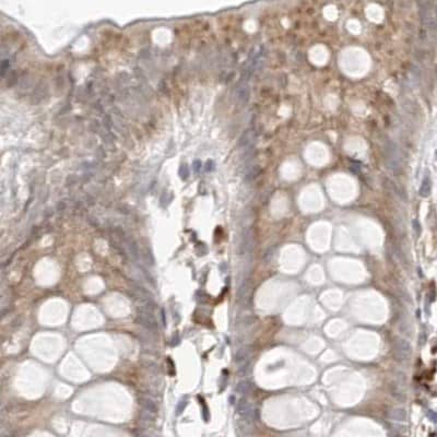 Ribophorin I Antibody - BSA Free Immunohistochemistry-Paraffin: Ribophorin I Antibody [NBP1-82467]