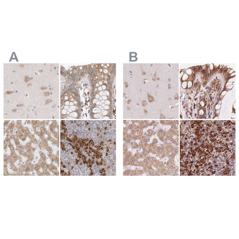 Ribophorin I Antibody - BSA Free Immunohistochemistry-Paraffin: Ribophorin I Antibody [NBP1-82467]