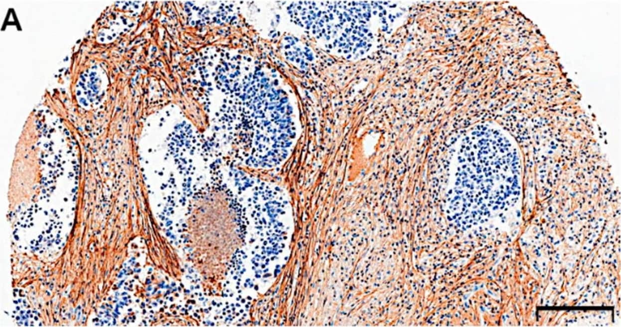 Periostin/OSF-2 Antibody