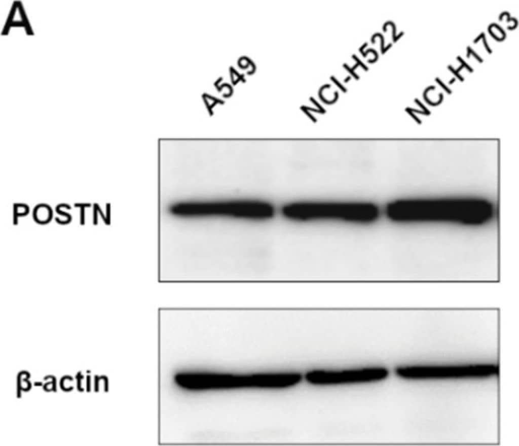 Periostin/OSF-2 Antibody
