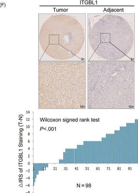 Integrin beta-like protein 1 Antibody - BSA Free