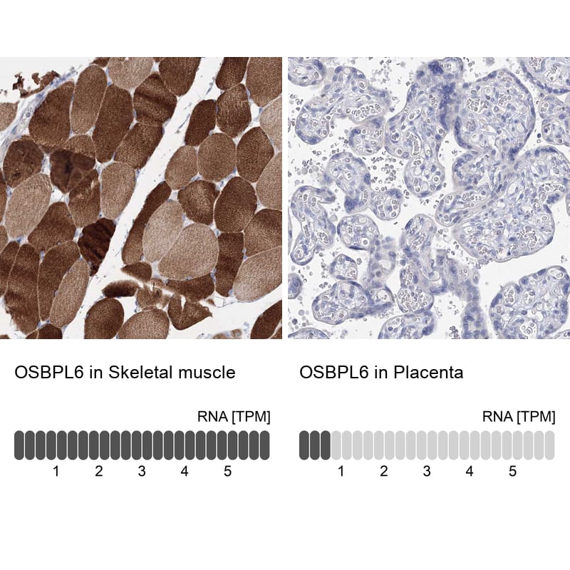 OSBPL6 Antibody - BSA Free Immunohistochemistry-Paraffin: OSBPL6 Antibody [NBP1-82475]