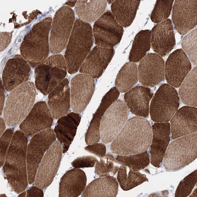 OSBPL6 Antibody - BSA Free Immunohistochemistry-Paraffin: OSBPL6 Antibody [NBP1-82475]